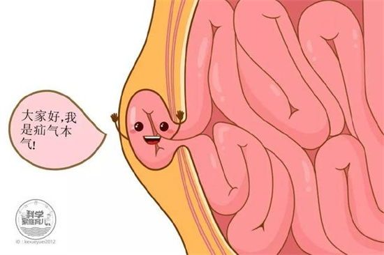 疝氣不“善”，勿因“疝”小而不為！