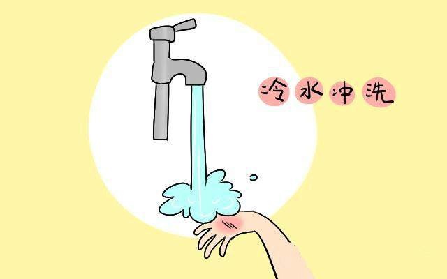 燙傷如何急救，牢記五個字！